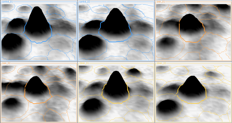 Automatic Contrast Setting